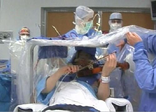 Un dispositivo colocado en el arco de Frisch fue crucial para realizar la cirugía. Los médicos crearon el mecanismo específicamente para esta operación. (Foto: Everydayhealth/Daily Mail)