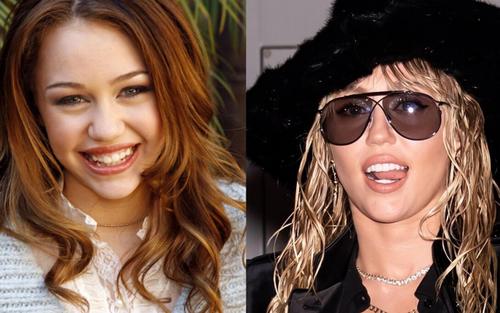 Miley tenía los dientes pequeños y pronto se los cambió. (Foto: Telemundo)