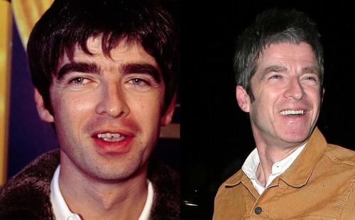Noel Gallagher con su nueva sonrisa. (Foto: Telemundo)