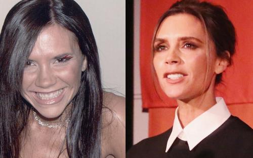 Victoria Beckham cambió su sonrisa. (Foto: Telemundo)