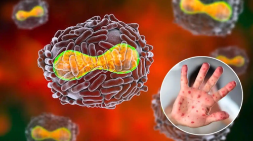 Europa concentra la mayoría de casos con 191, de los que 118 se sitúan en países de la UE. Canadá (15), Estados Unidos (9), Australia (2), Israel (1) y Emiratos Árabes Unidos (1) son los países no europeos con casos. (Foto: elespanol.com)