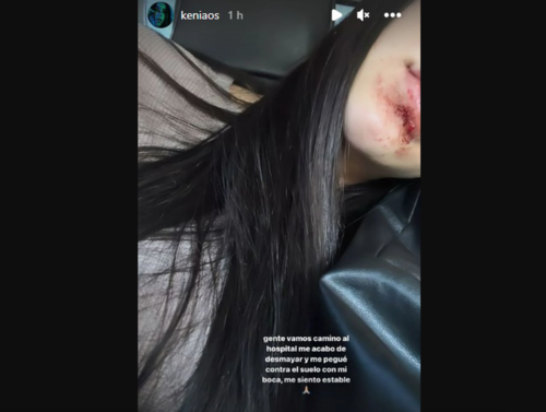 Kenia Os se golpeó el rostro, tras desmayarse y caer al suelo. (Foto: captura pantalla)