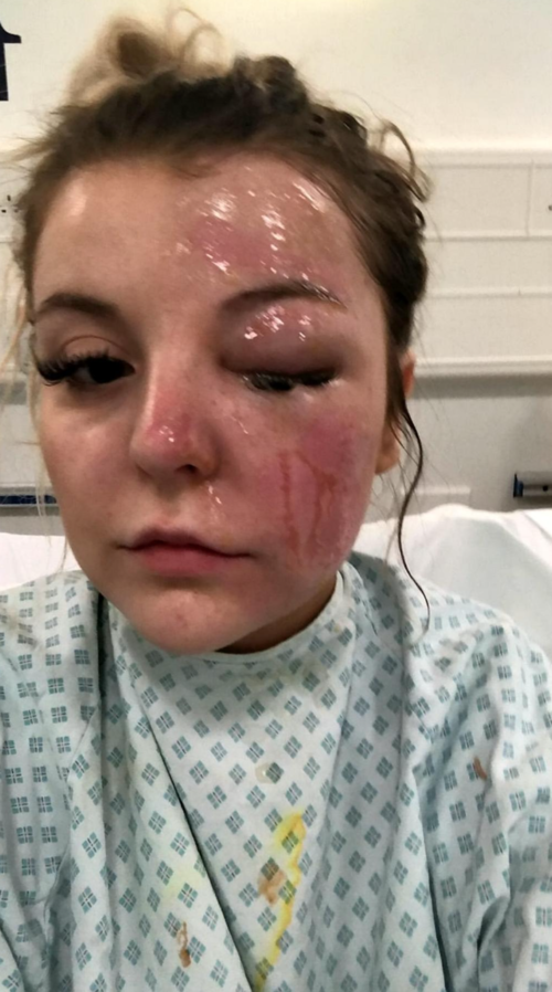 Bethany Rosser en el hospital. (Foto: SWNS.com)