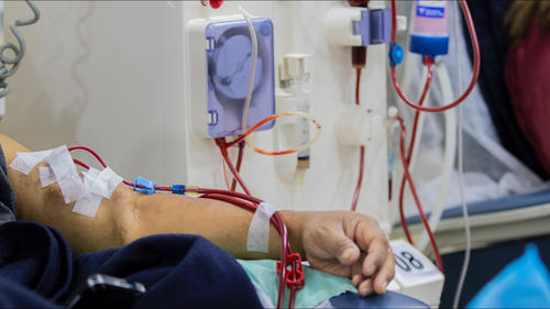 De acuerdo con el Ministerio de Salud, los enfermos renales crónicos figuran entre los pacientes que más se beneficiarían con la Ley de Trasplantes. (Foto: Archivo/Soy502)