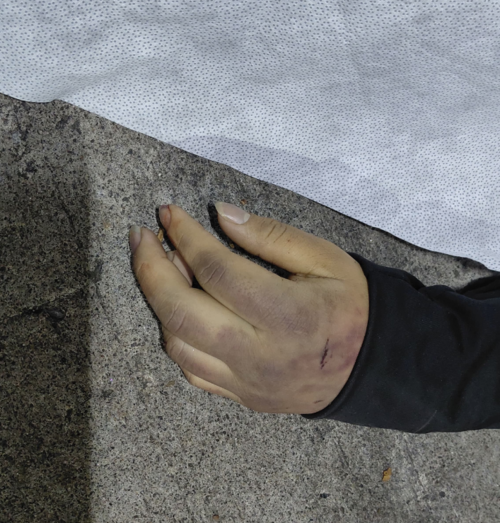 La víctima presentaba golpes y señales dd violencia en distintas partes del cuerpo, según información preliminar. (Foto: Bomberos Municipales)