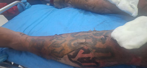 El ahora fallecido tiene tatuajes que lo podría vincular con alguna pandilla. (Foto: Jorge Senté/Colaborador)