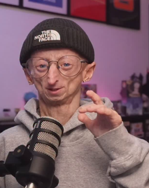 Michiel Vandeweert, muerte, influencer, envejecimiento, prematuro, progeria, soy502 noticias, Guatemala