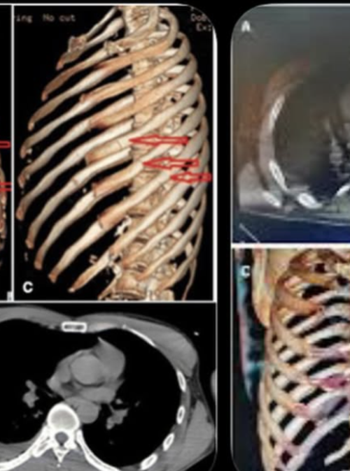 el precio de la historia