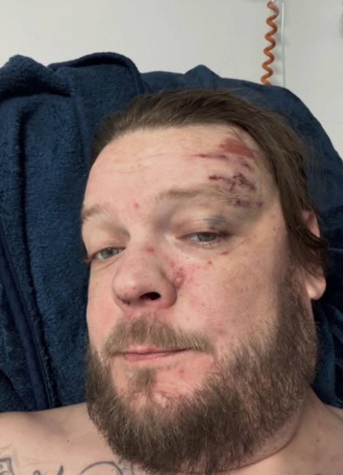 corey harrison precio de la historia 4