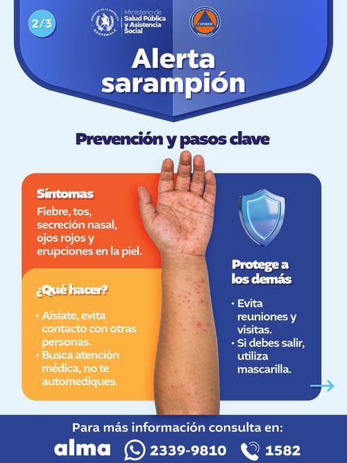 Información sobre síntomas del Sarampión. (Foto: MSPAS)