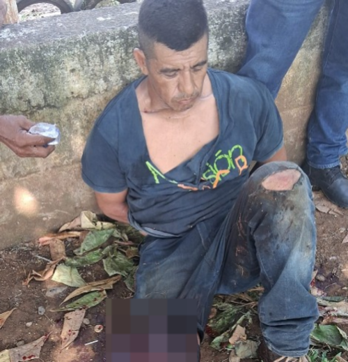 El hombre a intentar arrebatarle el arma a uno de los agentes policiales, terminó con una herida de bala en la pierna. (Foto: PNC)
