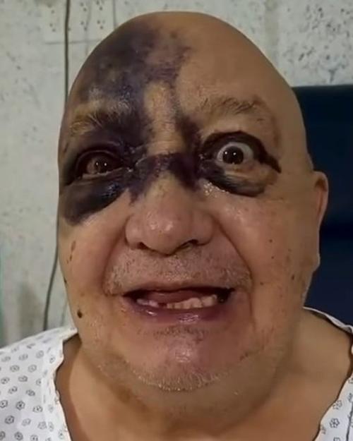 luis de alba