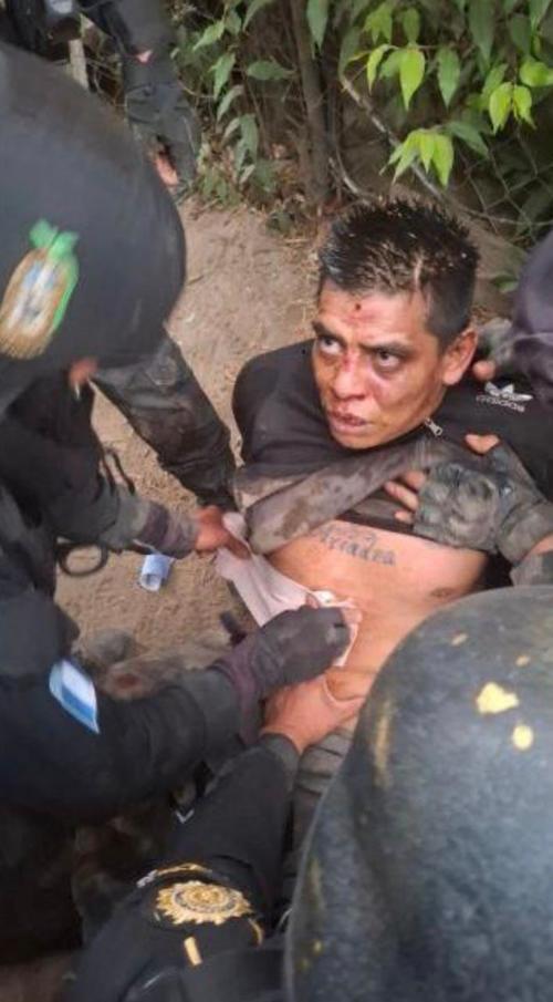 "Inquieto" resultó herido. (Foto: PNC)