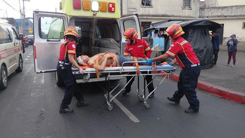 El herido fue identificado como: Lester Montepeque Álvarez. (Foto: Bomberos Municipales)