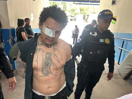 El hombre capturado terminó herido durante su retención. (Foto: PNC)