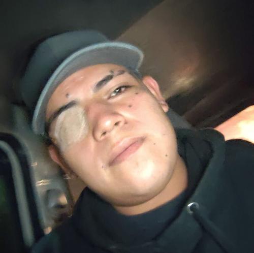 La víctima es Alexis Muñoz Orellana, quien había perdido un ojo en otro ataque. (Foto vía: Marzy Ruiz/Colaboradora)