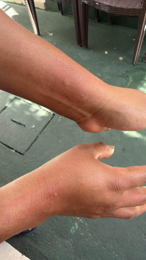 La contaminación del agua provocó alergias y quemaduras en la piel de los vecinos. (Foto: Redes sociales)