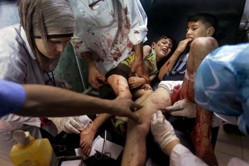 Niños heridos en la ciudad de Alepo, Siria, después de un bombardeo. Foto Ricardo García Vilanova/Free lance El Mundo