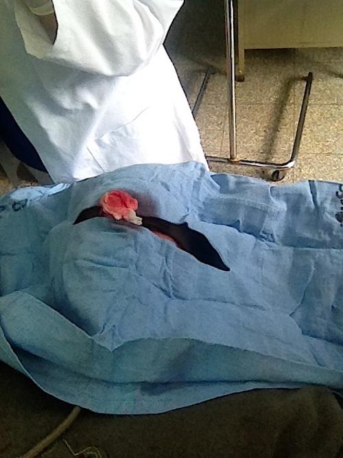 Milagrosamente, fueron pocas las heridas sufridas en el accidente. Una de ellas fue un golpe severo en la nariz que ameritó una operación y varios puntos de sutura.