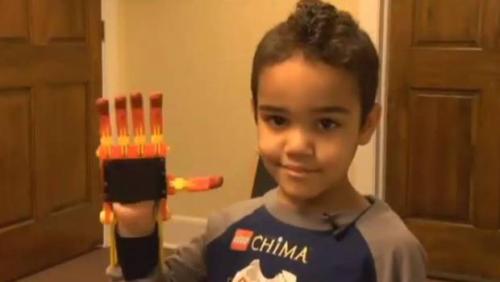 Niño prótesis de Iron Man