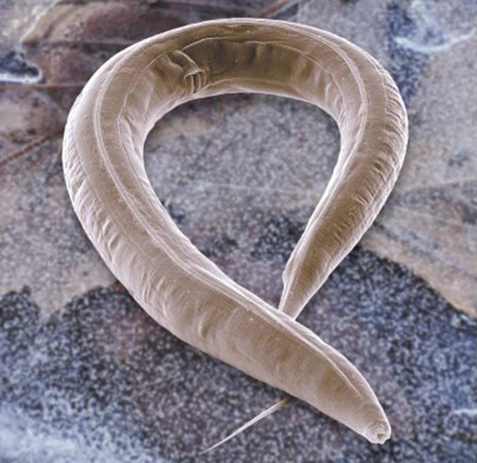 Imagen microscópica de un gusano nematodo llamado Caenorhabditis elegans. (Foto: EFE/CSIC/Archivo)