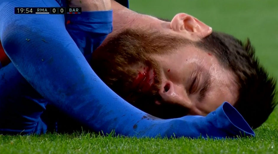 Lionel Messi tuvo que ser asistido por los médicos del Barcelona. (Foto: Twitter/@SC_ESPN)