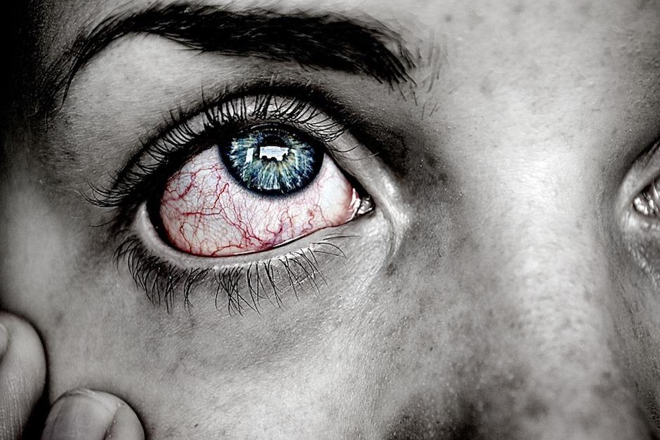 El enrojecimiento de los ojos está asociado con el dilatamiento provocado por una infección o alguna forma de irritación. (Foto: Pixabay)