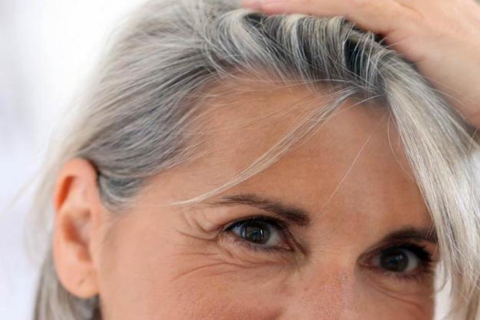 Algunas investigaciones han relacionado el aparecimiento del cabello blanco con el estrés de las personas. (Foto: Hola Doctor)
