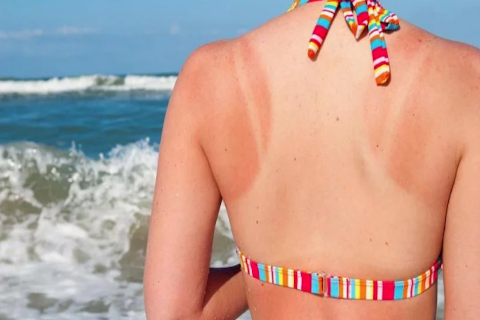 Estos consejos te permitirán calmar, hidratar y nutrir tu piel de forma natural. (Foto: El Botiquín)