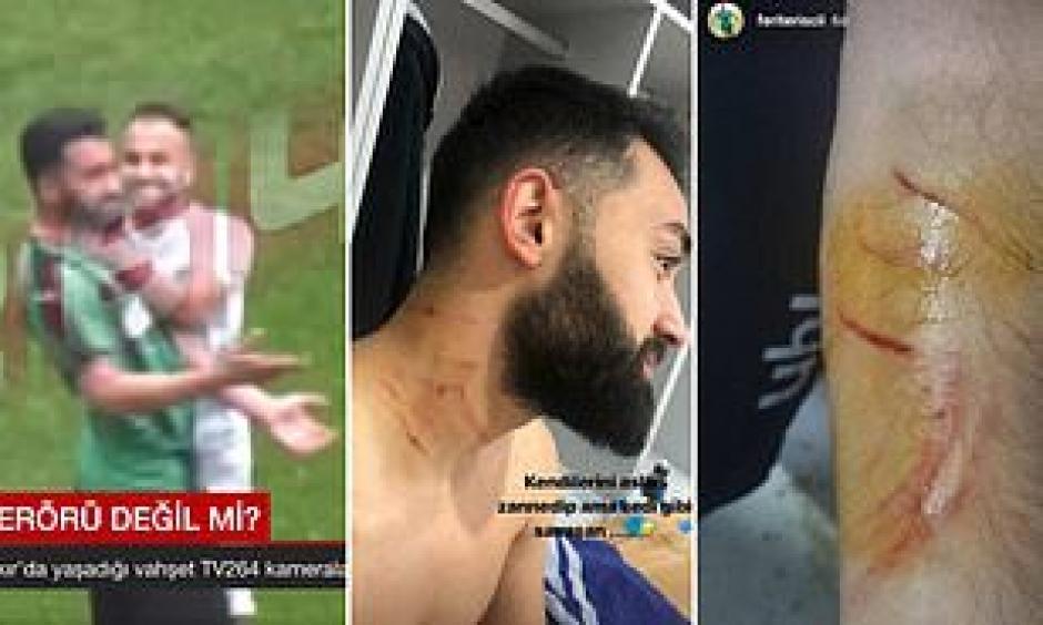 Un futbolista turco agredió a sus rivales con una cuchilla y les ocasionó varios cortes. Insolitamente no fue ni amonestado. (Foto: Captura de video)