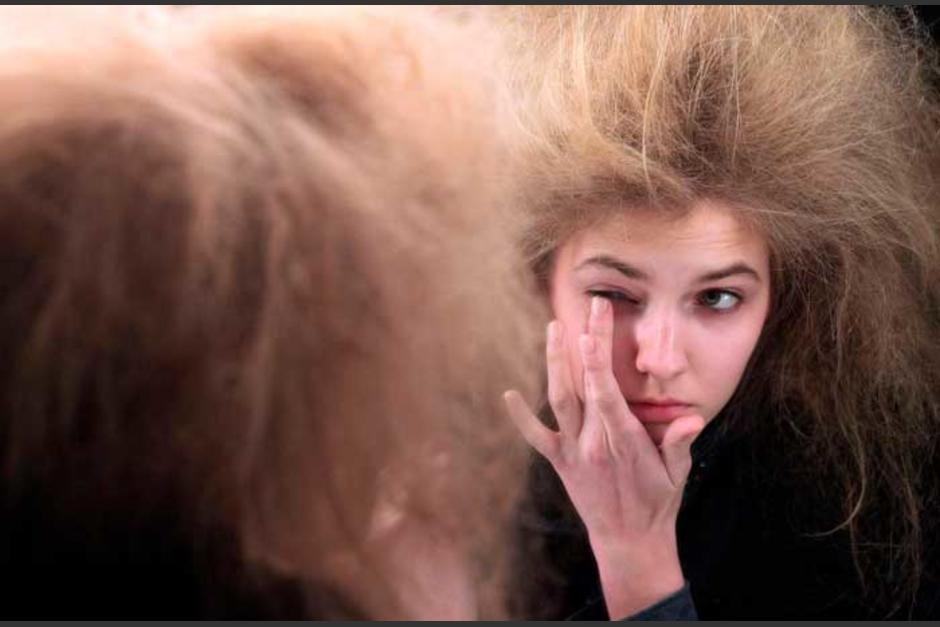 Deja el peina y la crema quietos y entérate quizá tienes este curioso síndrome. (Foto 