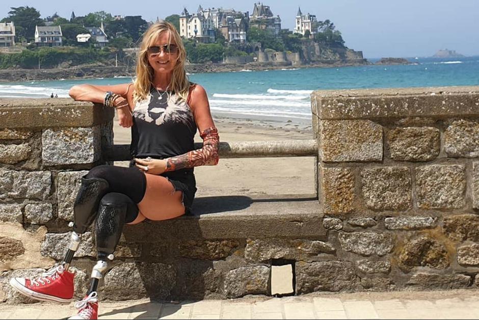 Una enfermera fue al hospital por una tos persistente y le amputaron las piernas y una mano. (Foto: Instagram)