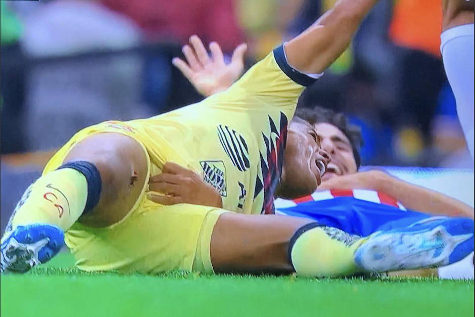 Giovani Dos Santos sufrió una dolorosa herida durante el Clásico del fútbol mexicano. (Foto: Captura)