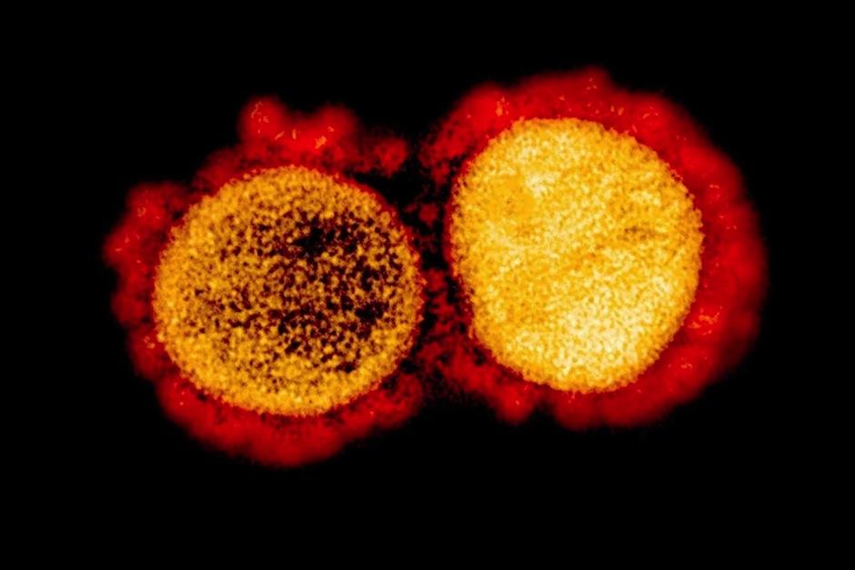 Investigadores descubrieron la vulnerabilidad de la proteína Spike del coronavirus. (Foto: AFP) 