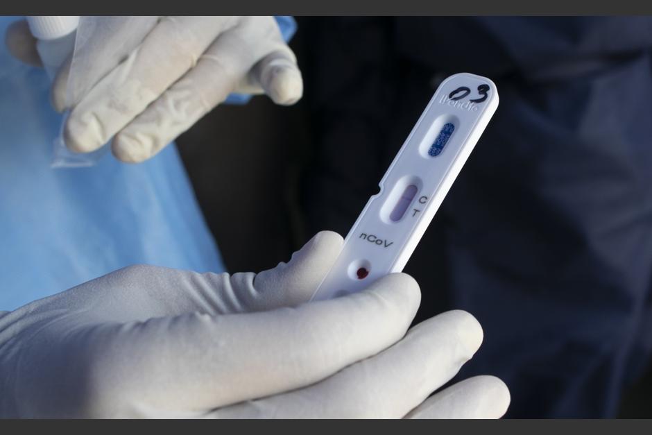 Las pruebas autorizadas se efectúan mediante hisopados y no a través de sangre. (Foto: Pixabay)