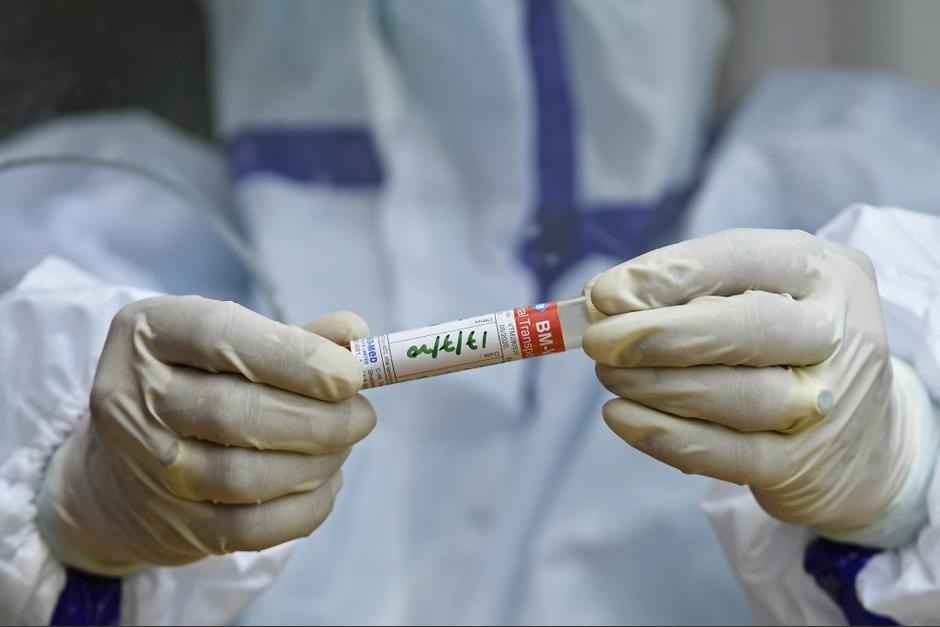 El Ministerio de Salud reveló los casos de este viernes. (Foto: AFP) 