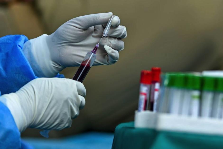 Así es la donación de plasma. (Foto: AFP) 