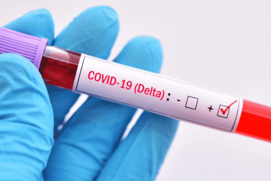 La variante Delta en Guatemala podría explicar el alto contagio de las últimas horas. (Foto: www.magazine.com) 