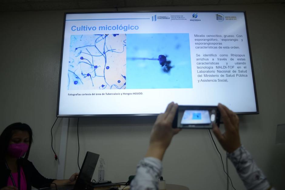 Las autoridades del Hospital General ofrecieron una conferencia de prensa este lunes 5 de julio. (Foto: Wilder López/Soy502) 