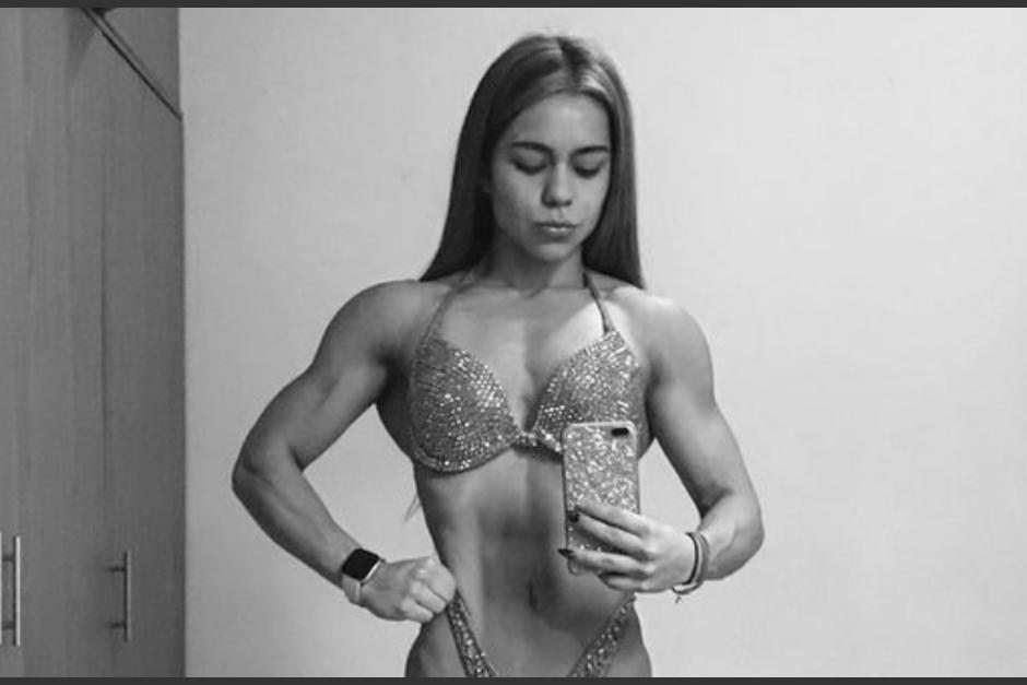 MiraDry es un tratamiento para la sudoración excesiva. (Foto: Instagram)