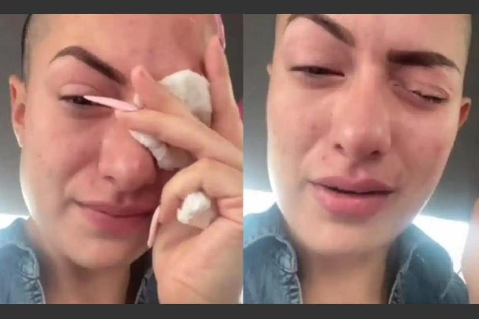 La influencer casi pierde un ojo por confundir sus gotas. (Foto: captura de pantalla)