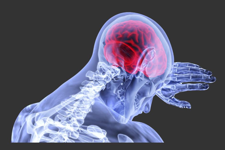 Un menor volumen de materia gris en esa región del cerebro se asocia a un mayor nivel de discapacidad. (Foto: Pixabay)