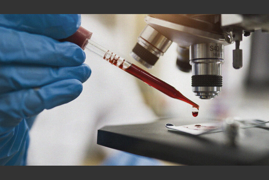 El estudio se ha realizado monitoreando a pacientes desde hace 6 años. (Foto: arcivo/Soy502)