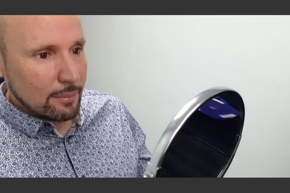 Steve Verze se ve en el espejo para sorprenderse con su nueva prótesis ocular. (Foto: Daily Mail)