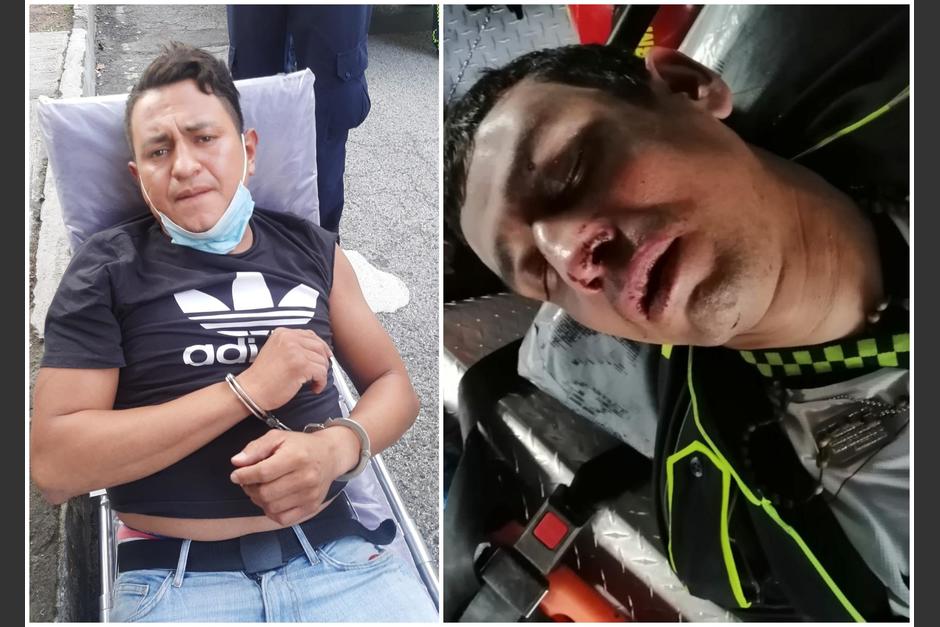 Un conductor agredió a un PMT que le pondría un cepo, luego varios agentes lo alcanzaron y arrestaron. (Foto: Soy502)