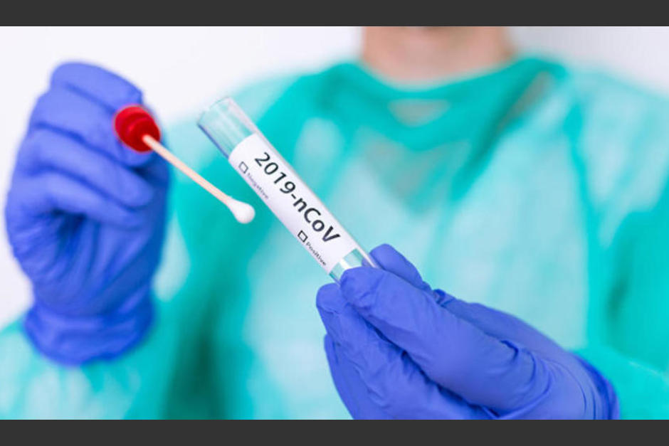 En algunos casos los test de PCR pueden seguir dando positivo, luego de que una persona ya está recuperada. (Foto: Colescba)