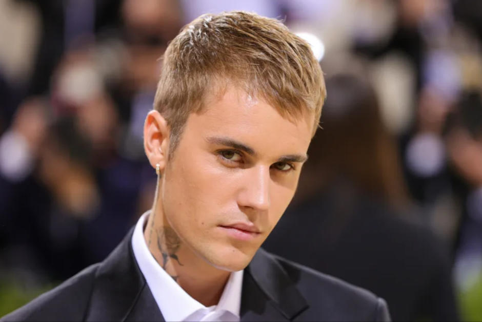 En esto consiste el padecimiento de Justin Bieber que le dejó paralizada la cara. (Foto: AFP) 