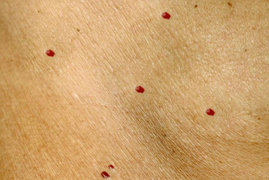 Estas manchas aparecen repentinamente y a veces provocan preocupación. (Foto: Oficial)