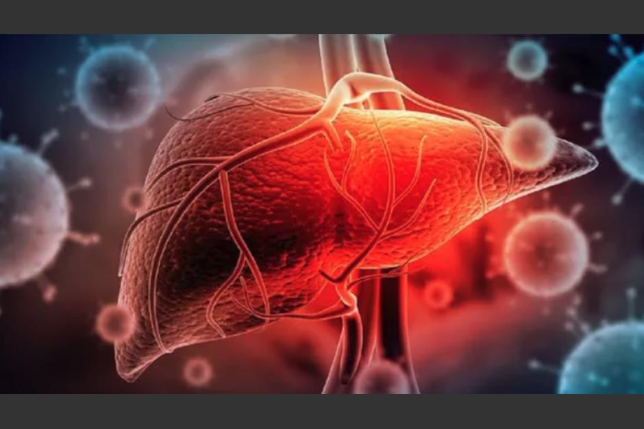 La enfermedad se ha presentado mayormente en Reino Unido, pero otros países ya lo han detectado. (Foto: Minuto Uno)