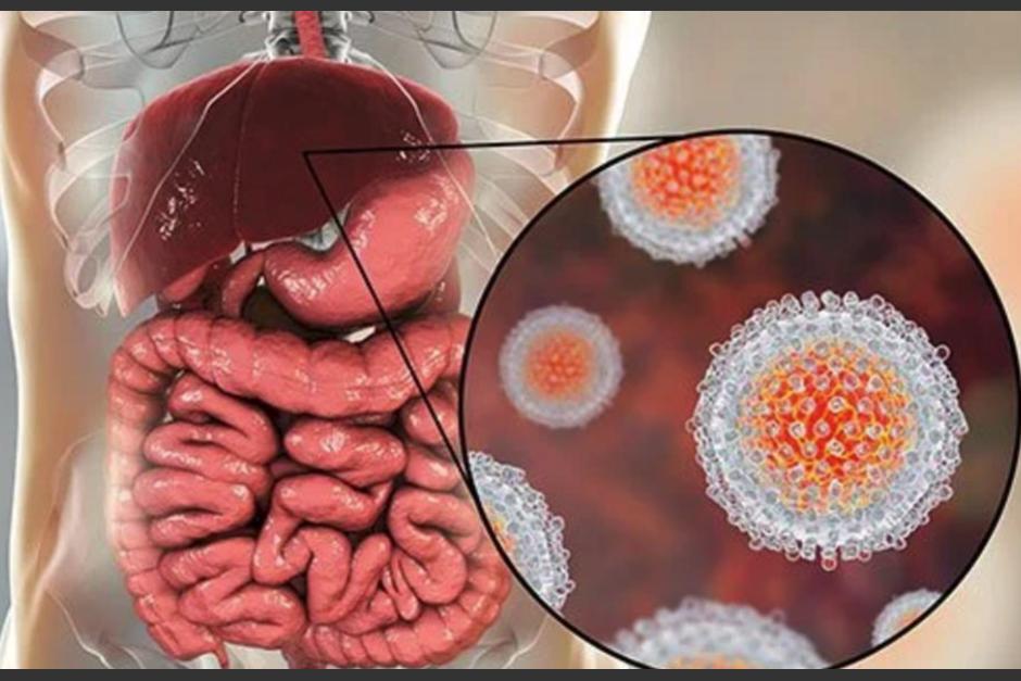 La hepatitis aguda infantil ha sido detectada en Latinoamérica y afecta especialmente a niños de hasta 5 años. (Foto: Emedecine health)